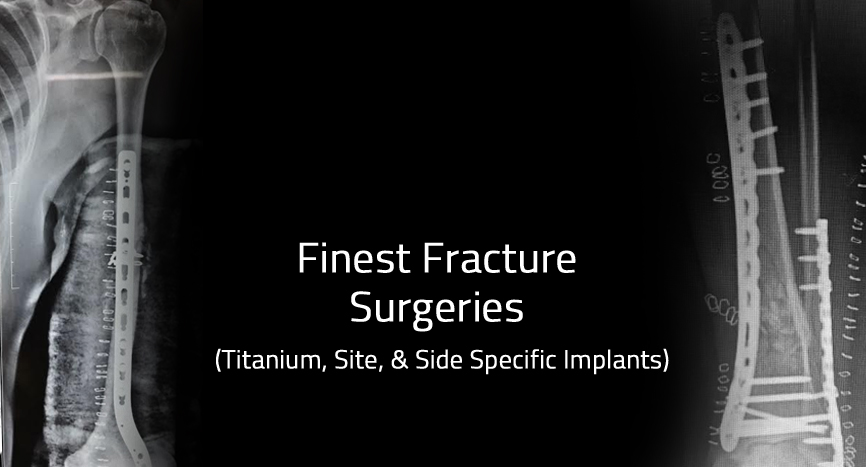 Finest Fracture Surgeries
