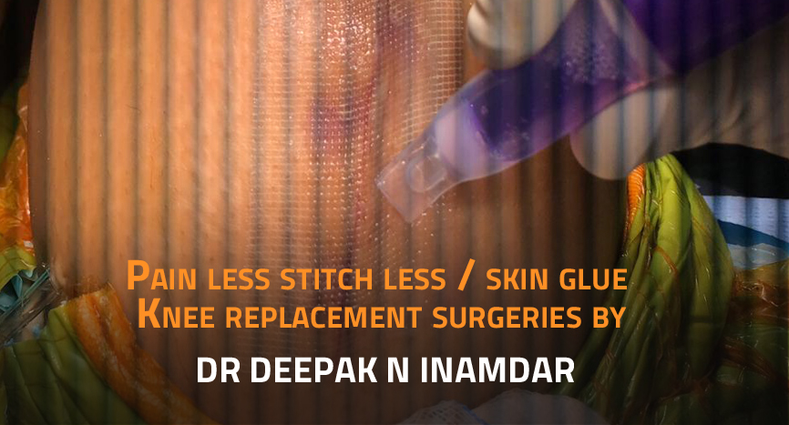 Skin Glue Knee Replacement Surgery