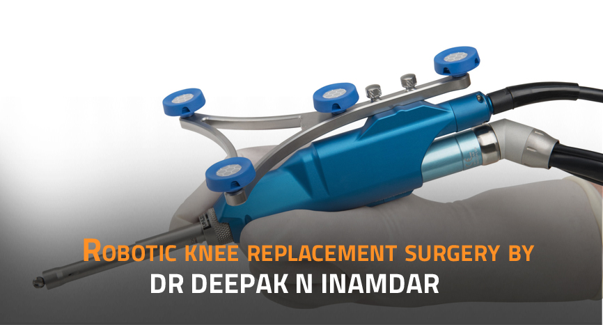 Robotic Knee Replacement Surgery