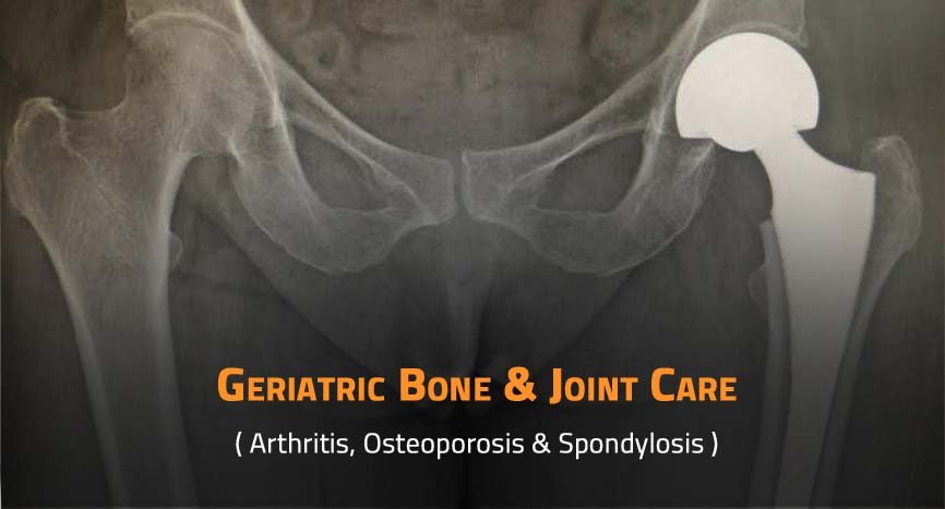Geriatric Bone and Joint Care