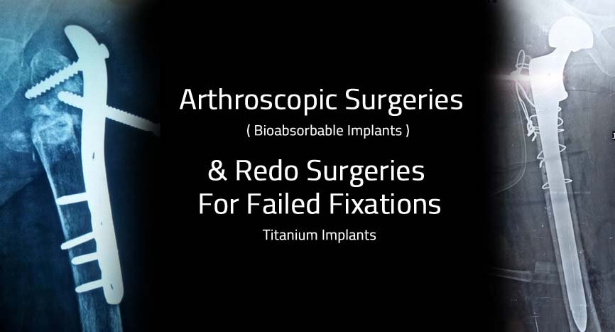 arthroscopic surgeries